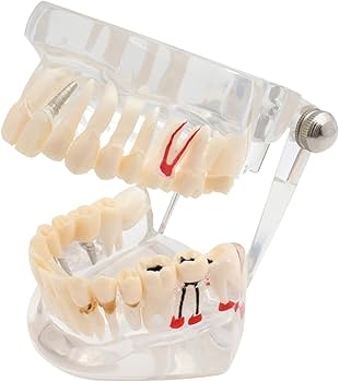 Mô hình tháo lắp răng, thực tập nhổ răng
