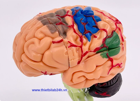 Mô hình bộ não 4D 32 phần tháo rời
