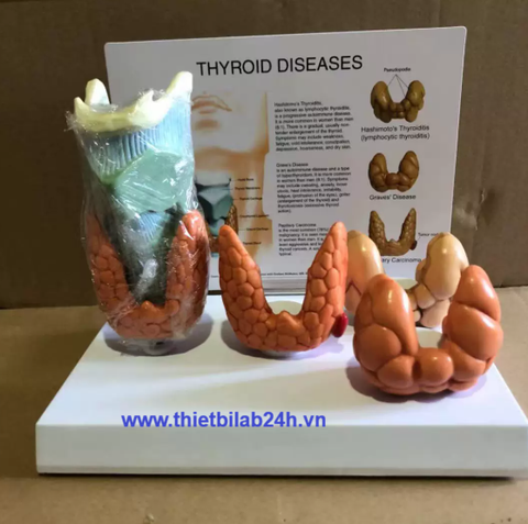 Mô hình bệnh lý tuyến giáp