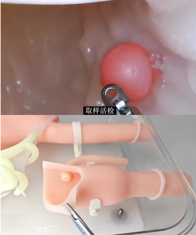 Mô hình huấn luyện phẫu thuật nội soi dạ dày, tá tràng