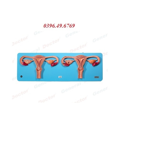 MÔ HÌNH TỬ CUNG VÒI TRỨNG BUỒNG TRỨNG MODEL GD/A42001