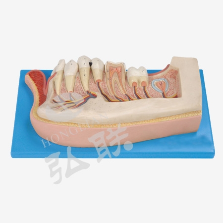 Mô hình phóng đại răng trẻ em và bệnh lý
