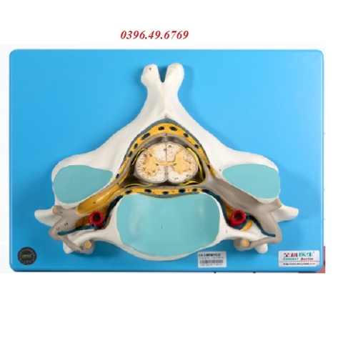 MÔ HÌNH CẮT NGANG TUỶ SỐNG MODEL GD/A18104