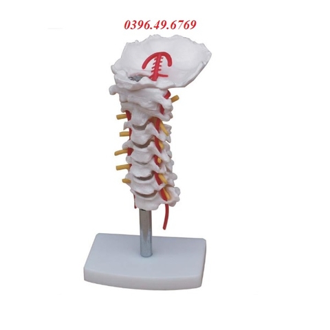 MÔ HÌNH CỘT SỐNG CỔ CÓ ĐỘNG MẠCH CỔ