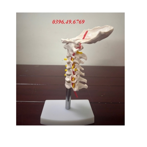 MÔ HÌNH CỘT SỐNG CỔ CÓ ĐỘNG MẠCH CỔ