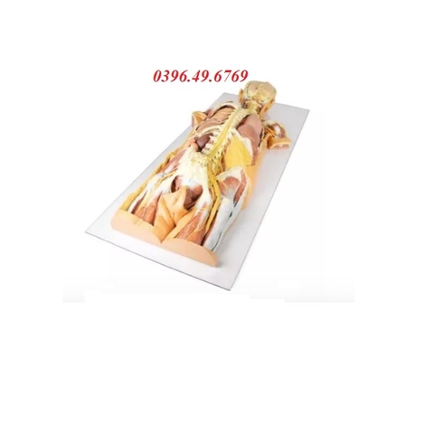 MÔ HÌNH GIẢI PHẪU 3D HỆ THẦN KINH BÓC TÁCH NHÌN TỪ PHÍA SAU MP1400 ZIMMER