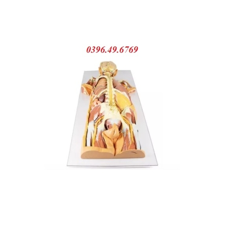 MÔ HÌNH GIẢI PHẪU 3D HỆ THẦN KINH BÓC TÁCH NHÌN TỪ PHÍA SAU MP1400 ZIMMER