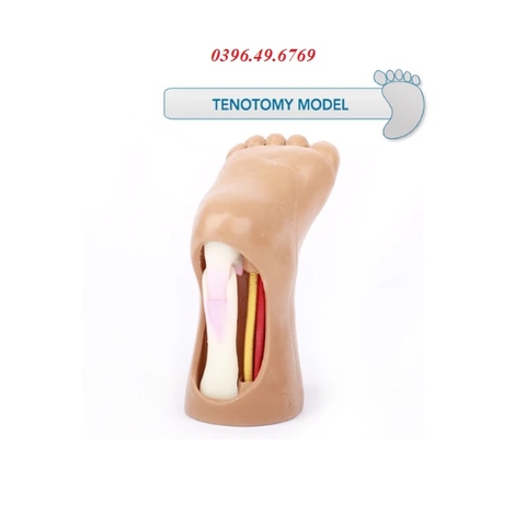 MÔ HÌNH THỰC HÀNH THỦ THUẬT CẮT GÂN GÓT CHÂN NHI KHOA