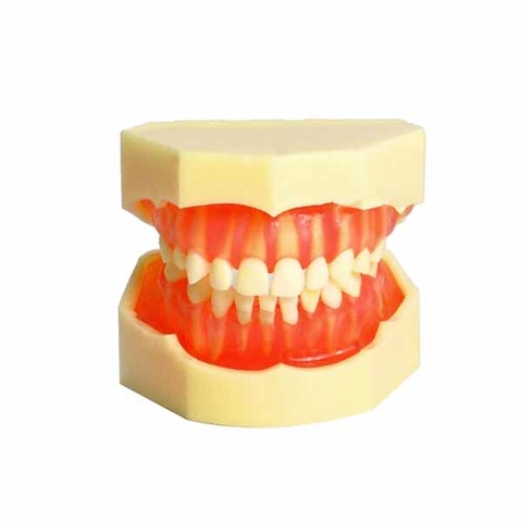 Mô hình răng trẻ em có thể tháo lắp (28 răng)