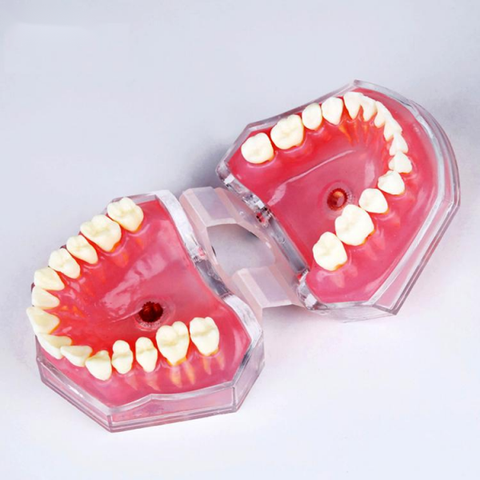 Mô hình răng bằng gôm mềm