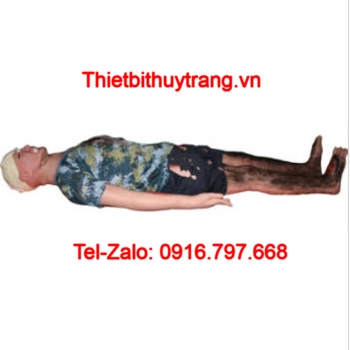 Mô Hình Cấp Cứu Bệnh Nhân Bỏng Toàn Thân WB802