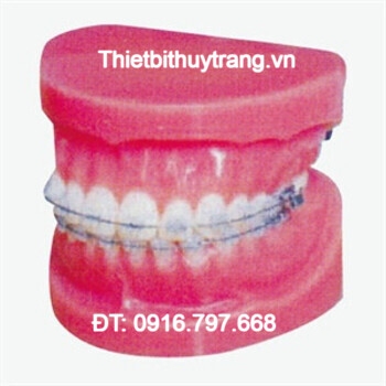 MÔ HÌNH GIẢI PHẪU CHỈNH NHA CỐ ĐỊNH GD/B10036