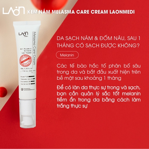 Kem nám LoanMedi Melasma Care Cream