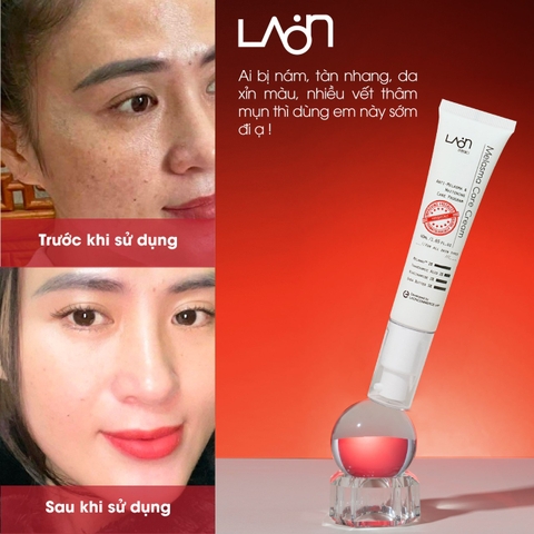 Kem nám LoanMedi Melasma Care Cream