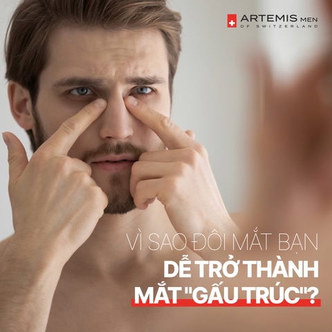 CẢI THIỆN QUẦNG THÂM BỌNG MẮT ĐÚNG CÁCH NHƯ THẾ NÀO?