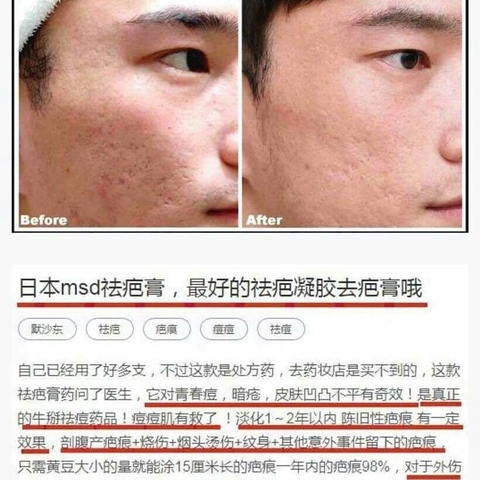 GENTACIN - 6M+KEM TRỊ SẸO NHẬT