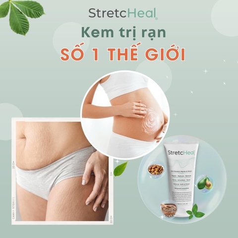 STRETCHEAL - KEM TRỊ RẠN DA MỸ