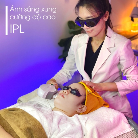 IPL - Trị mụn và thâm cùng Ánh Sáng xung cường độ cao