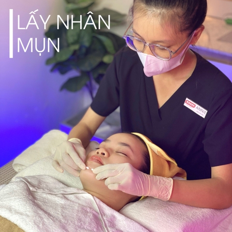 Lấy nhân mụn chuẩn Y khoa