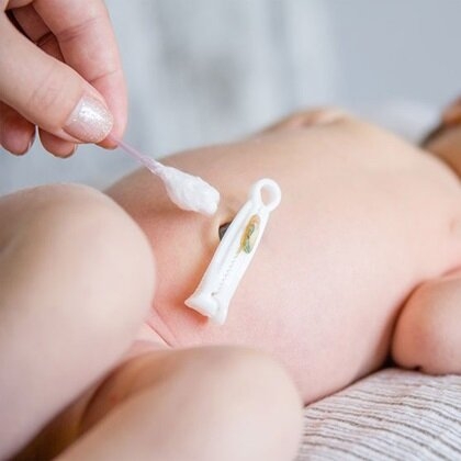 Hướng dẫn bố mẹ chăm sóc vùng rốn trẻ sơ sinh đúng cách