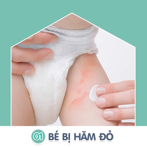 Bỉm BebeJOY Premium có phù hợp với bé có da nhạy cảm dễ kích ứng không?