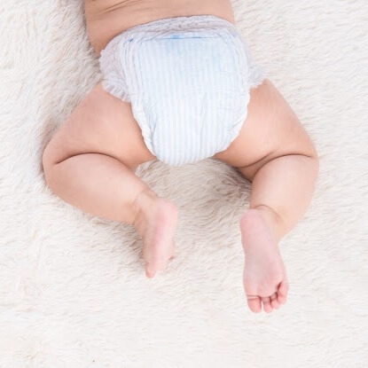 Bé bị hăm có phải do chọn sai bỉm mùa hè cho bé