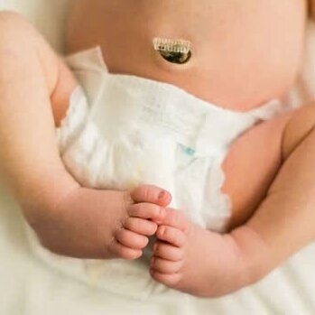 4 dấu hiệu sức khỏe của bé sơ sinh mẹ cần lưu tâm