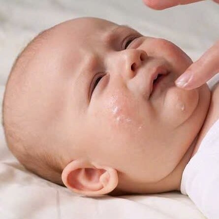 3 bệnh lý về da thường gặp ở bé sơ sinh
