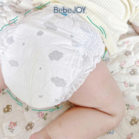 Dấu hiệu bé bị dị ứng với bỉm