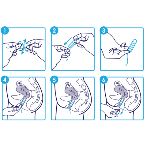 Băng Vệ Sinh Tampon Sofy Soft Nhật Bản [9 miếng/hộp]