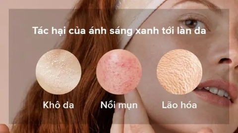 Bảo vệ da mặt trước màn hình máy tính cùng chuyên gia