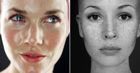 Da khô dầu - Bí quyết chăm sóc cho làn da không còn khô cằn