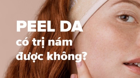 Giải đáp thắc mắc: Peel da có trị nám được không?
