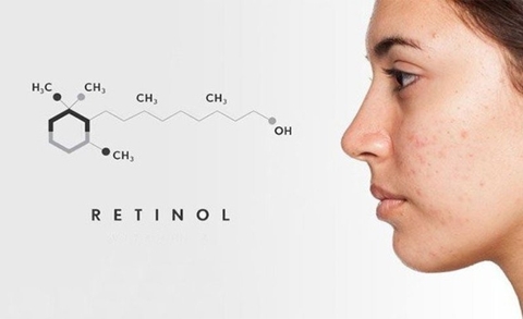 Tìm hiểu retinol là gì? Tác dụng và lưu ý khi sử dụng retinol