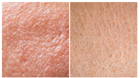 Da hỗn hợp: Cách nhận biết và chăm sóc da đúng cách