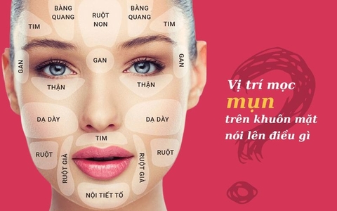 Bật mí vị trí mụn trên khuôn mặt nói lên điều gì?