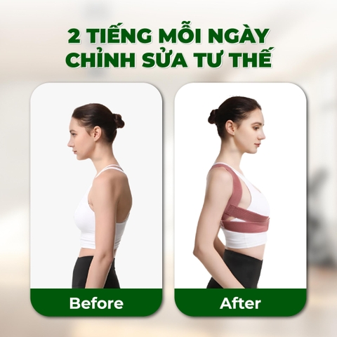 Đai Bảo Vệ Vòng 1, Đai Nâng Ngực Nữ,  Chống Gù Lưng Nam Nữ  Có Nẹp Chỉnh Cột Sống