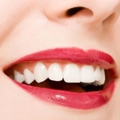 Răng sứ thẩm mỹ bền đẹp tự nhiên bằng công nghệ Veneers