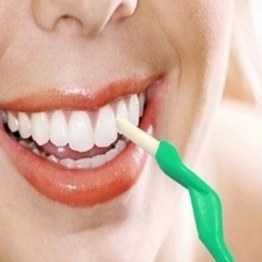 Tẩy trắng răng an toàn, hiệu quả tại Phòng khám Răng Hà Nội