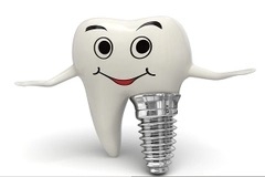 Hệ thống Implant sử dụng