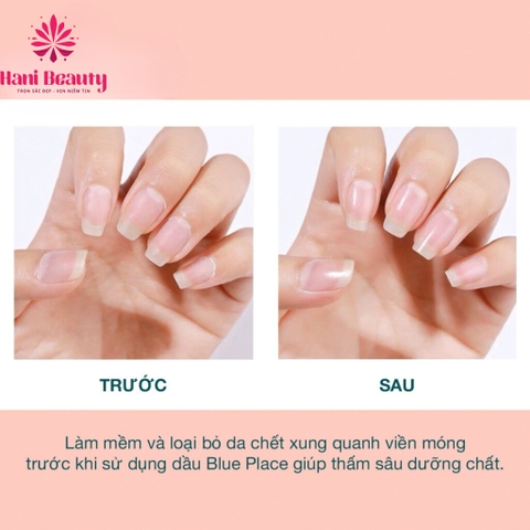 Dầu Tháo Móng Up