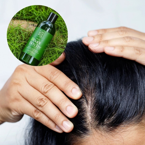 Da Đầu Nhờn Gội Hoài Vẫn Bết - Nguyên Nhân Từ Đâu?