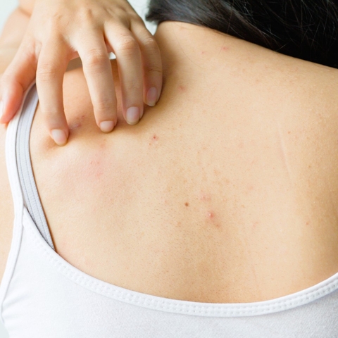 Da Body Có Cần Chăm Như Da Mặt Không? Câu Trả Lời Là Có, Nhưng Dịu Nhẹ Thôi