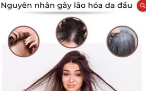 Giải Quyết Các Vấn Đề Chính Của Lão Hóa Da Đầu Chỉ Với 3 Bước