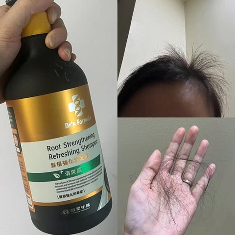 Dầu gội giảm rụng an toàn cho mẹ bầu và sau sinh – Dr's Formula Root Strengthening Refreshing Shampoo