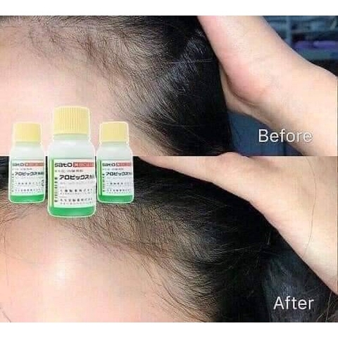 Tinh Chất Mọc Tóc Thảo Dược SATO JG Nhật Bản 30ml - Tách Lẻ 1 Lọ
