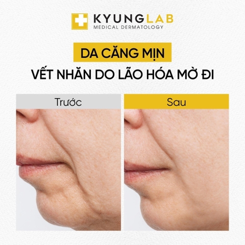 xịt khoáng dưỡng da kyung lab pdrn therapy mist công thức màng phủ 3 trong 1 cấp ẩm bảo vệ da 150ml