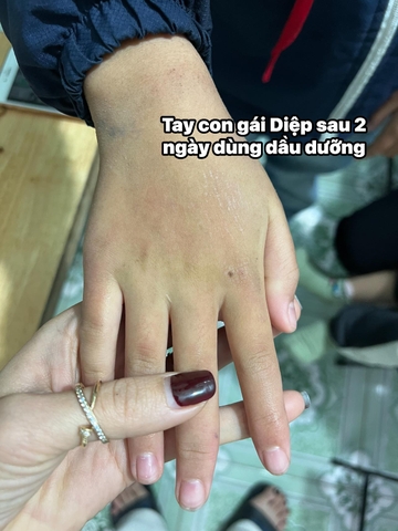 Dầu Dưỡng Thể Căng Bóng, Cấp Ẩm Giúp Da Mềm Mại Neutrogena Body Oil Light- 250ml- Úc