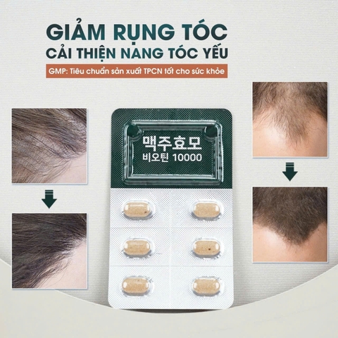 Viên uống mọc tóc Brewer’s Yeast Biotin Hàn Quốc 60 viên
