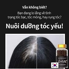 Viên uống Hà Thủ Ô Rootonix Hàn Quốc giúp giảm rụng tóc, bạc tóc_Hộp 3 lọ